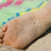 athlete's foot